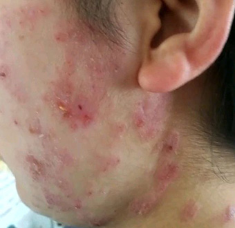 据统计：上海每年的供卵试管婴儿周期数目前已超过90万个