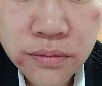 上海的供卵试管婴儿过程是怎样的？