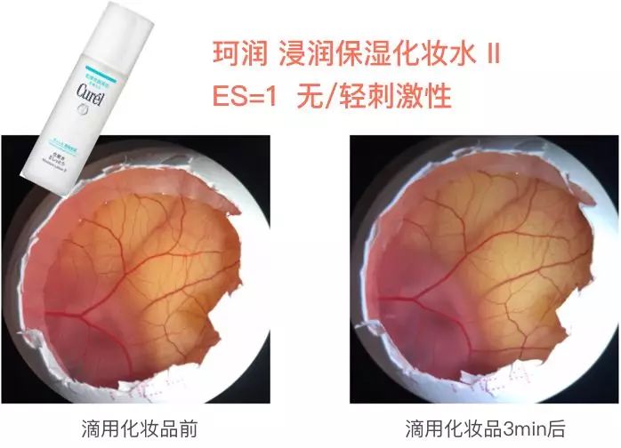 第二代借卵试管婴儿是什么意思？