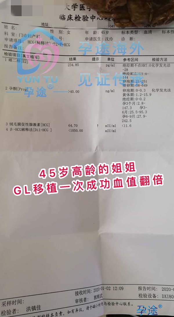 去上海做供卵做试管婴儿之前在上海需要做什么？