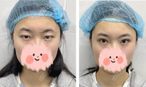 丈夫要做哪些检查来为宝宝做孕前准备？