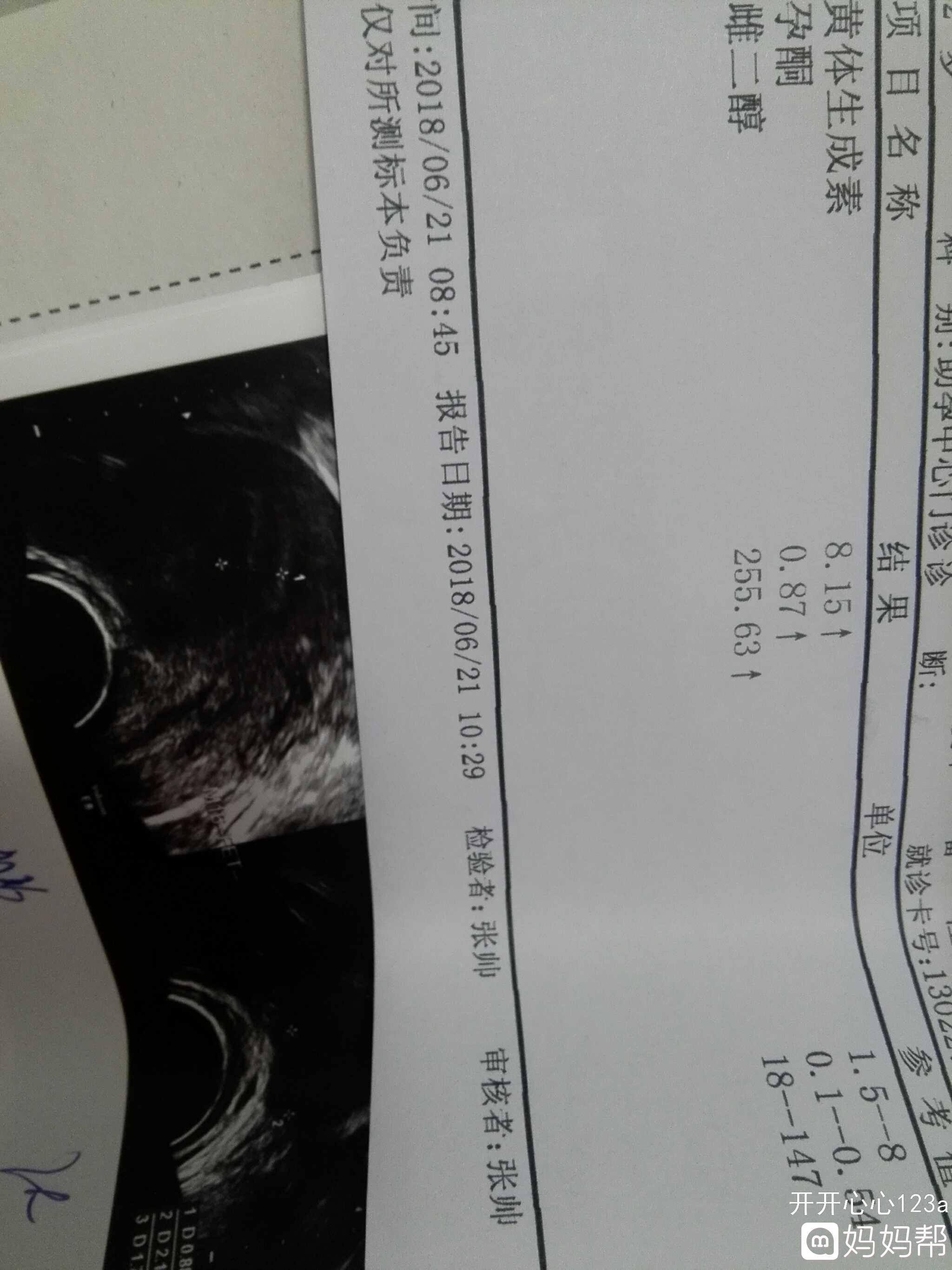 试管双胞胎几率大吗