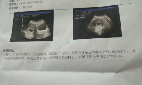 上海附二院试管婴儿成功率