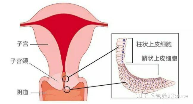 腺肌症子宫大试管移植+子宫腺肌症试管移植9周+5