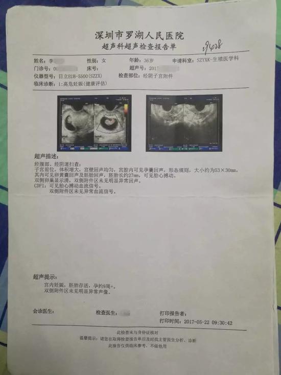 试管移植21天流产需清宫吗