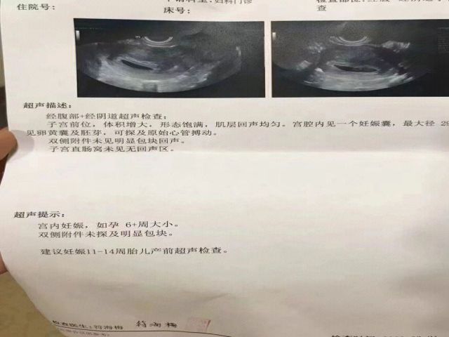 胚胎移植和囊胚移植哪个好+胚胎移植后吃什么坚果好