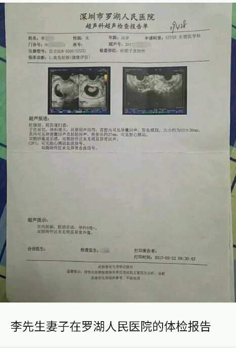 精子活动率20能治好吗