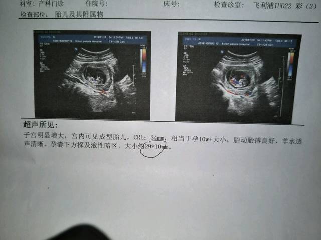 试管促排打丽申宝的作用