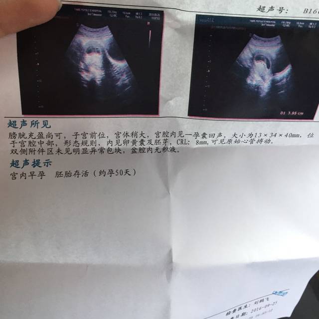 上海武警医院供卵生子费用是多少（有哪些影响因素？）