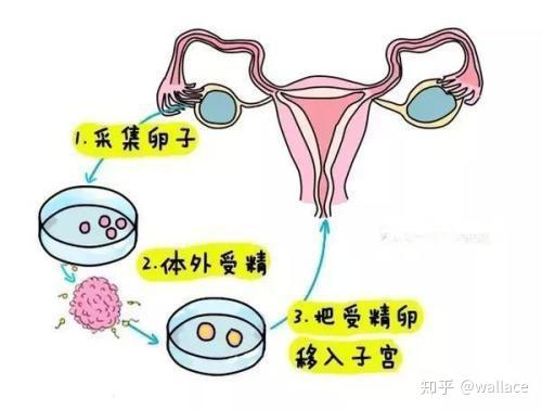 在中信湘雅正规代生