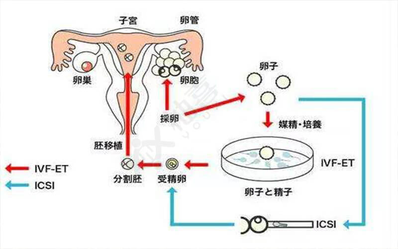 上海三代做试管包男孩多少钱价格表（有没有在上海市三院做试管选性别的）